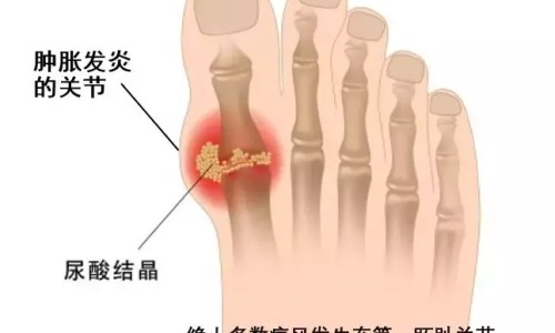 癌症病人能晒太阳吗有影响吗-癌症病人能晒太阳吗网癌症患者晒太阳注意事项知识网站,分享癌症病人能晒太阳吗为什么大全